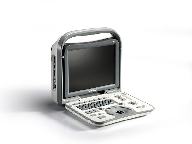 echographe portable noir et blanc SonoScape A6 2 ~ ELOI Echographie